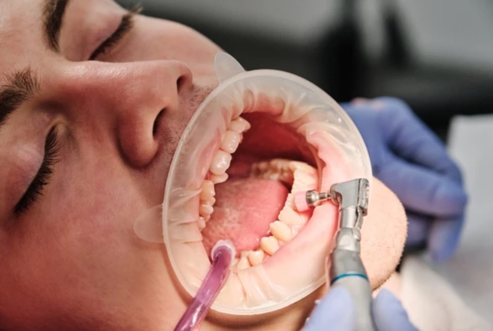 Pearly White Teeth