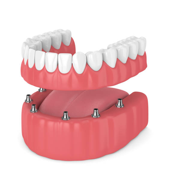 V Cure Dental & Implant Centre Care