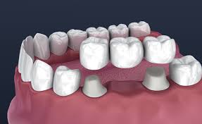 Experienced Dentists