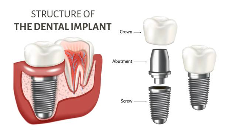 Dental Technology