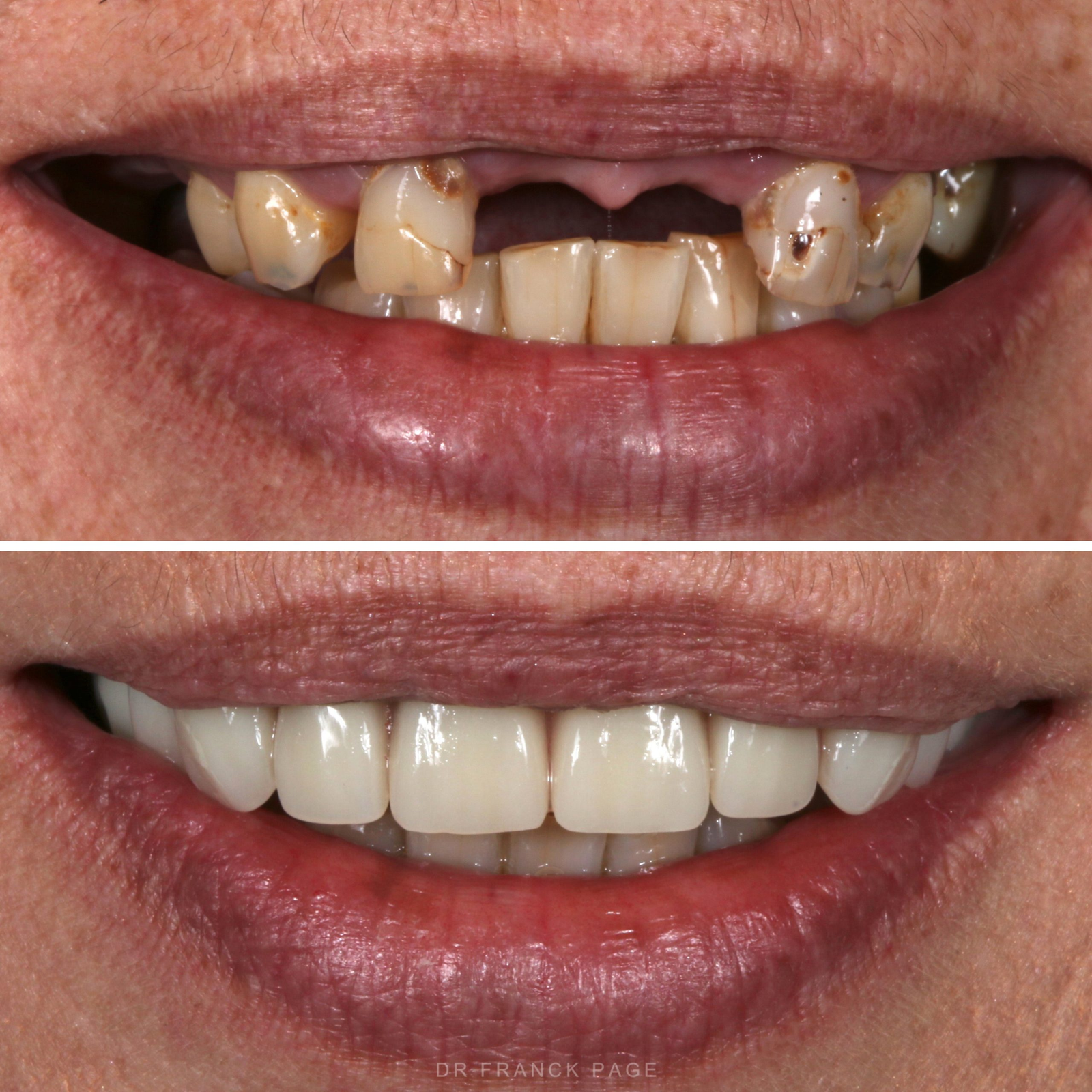 Advanced 3D Dental Planning