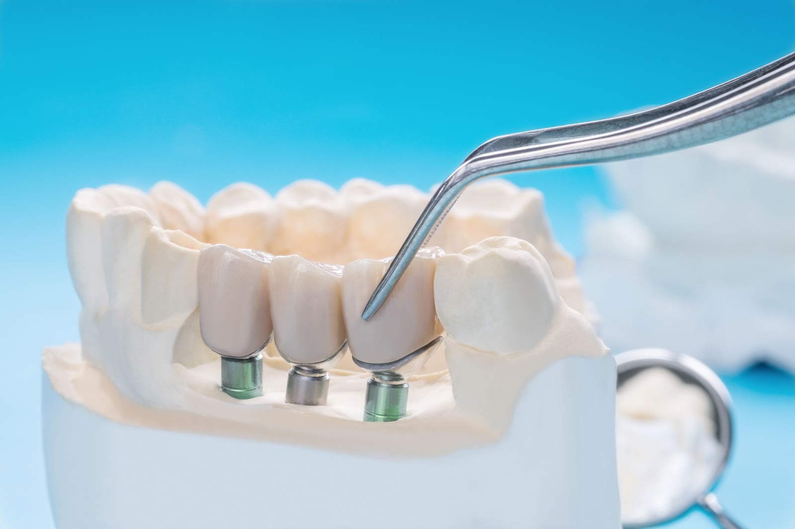 Painless Dental Treatment