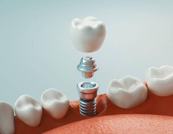 Painless Dental Treatment