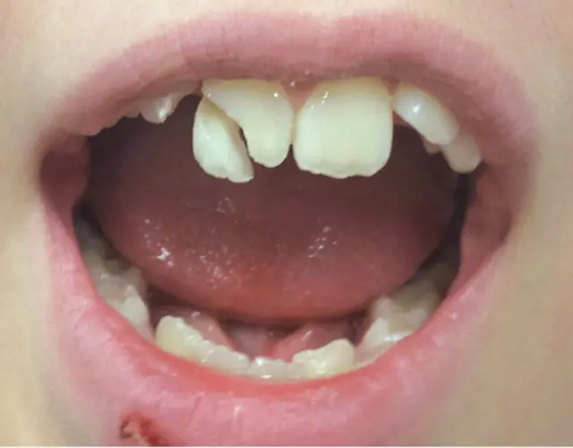 Friendly Pediatric Dentist