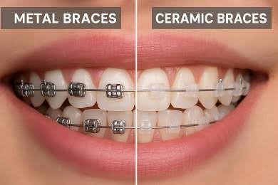 Dental Risks