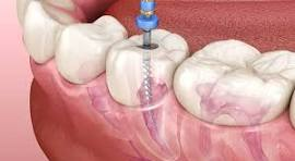 Sterilization Protocols